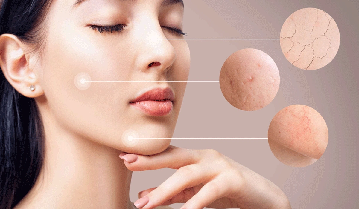 Adapt to Your Skin Type and Concerns